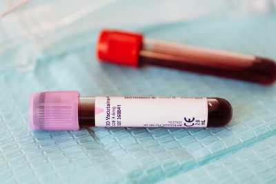 Подтверждена смерть ещё пяти пациентов с коронавирусом в Хакасии