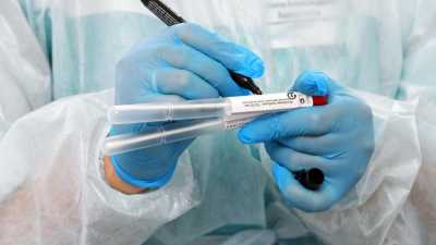 В Хакасии подтвердили 49 новых случаев заболевания COVID-19