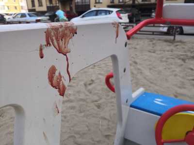 Кто-то оставил на детской площадке в Абакане кровавые следы