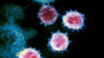 Ситуация с коронавирусом в Хакасии под контролем