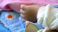 В Хакасии госпитализированы  дети с ожогами