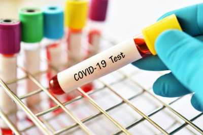В Хакасии еще 22 человека заразились COVID-19