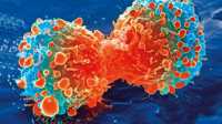 Ученые назвали основную причину возникновения рака