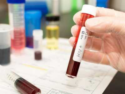 Жителям Саяногорска предлагают анонимно сдать кровь на ВИЧ