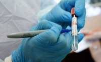 Ещё у 25 жителей Хакасии подтвержден коронавирус
