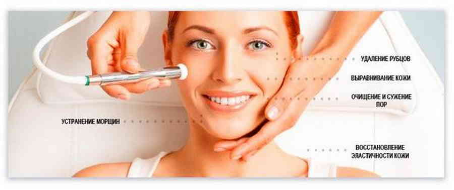 Фото галереи